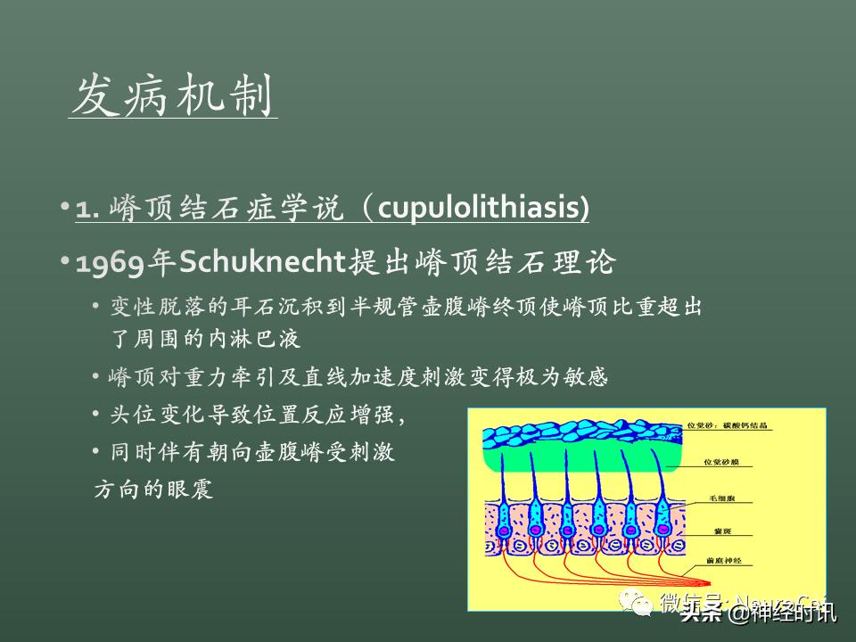 良性位置性眩晕诊断和治疗指南,良性阵发性位置性眩晕的诊断标准