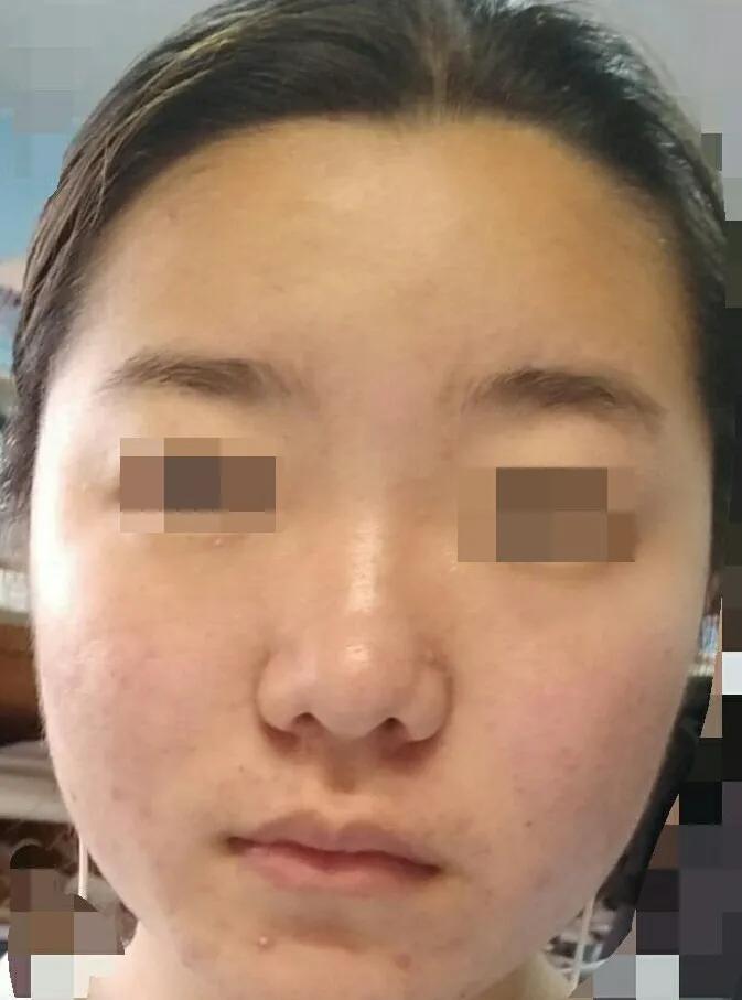 韦敏做鼻子怎么样,韦敏最新视频全集