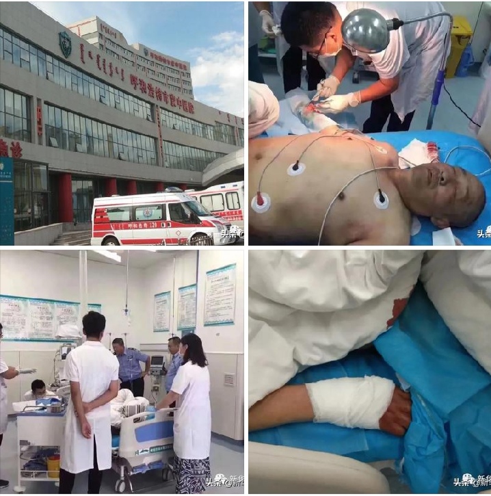 几天前南湖湿地公园割腕男子出院家属曾不愿露面蒙中医院暂垫付全部医疗费