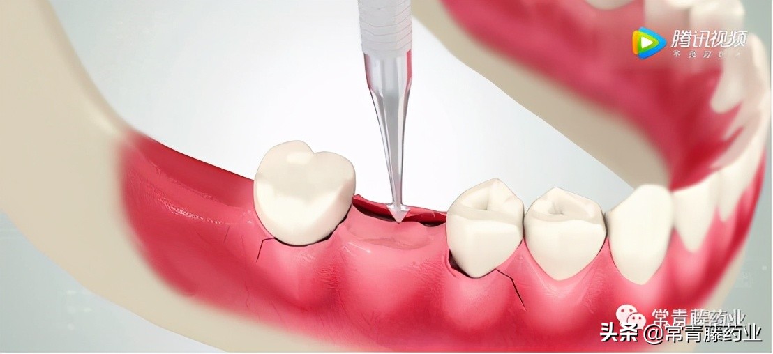 七岁小孩拔牙有危害吗,七岁儿童拔牙需要扶正吗