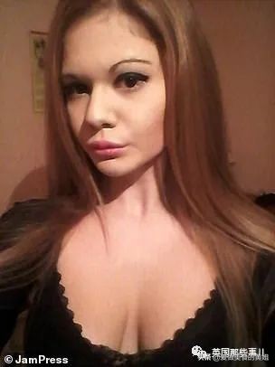 20次整容成功的女人,22岁女人做20次丰唇手术