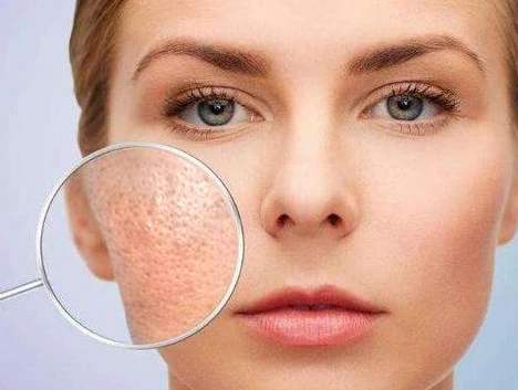 毛孔粗大怎么办教你一招根除,毛孔粗大怎么让毛孔变得细腻