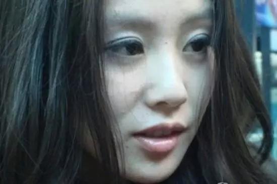 脸垮法令纹深最省钱的办法,脸垮了法令纹该怎么办