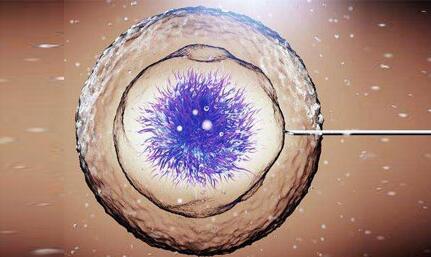 做试管婴儿需要问哪些问题,试管婴儿女士都需要经历什么