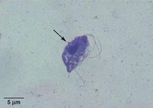 猫感染球虫滴虫用什么驱虫药,猫咪球虫滴虫怎么治疗最有效