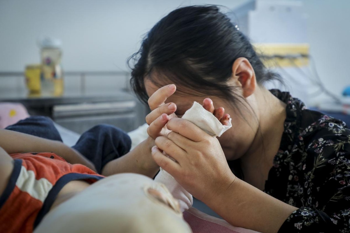 孩子被开水烫伤母亲却只心疼杯子,小孩掉进开水盆80%烫伤