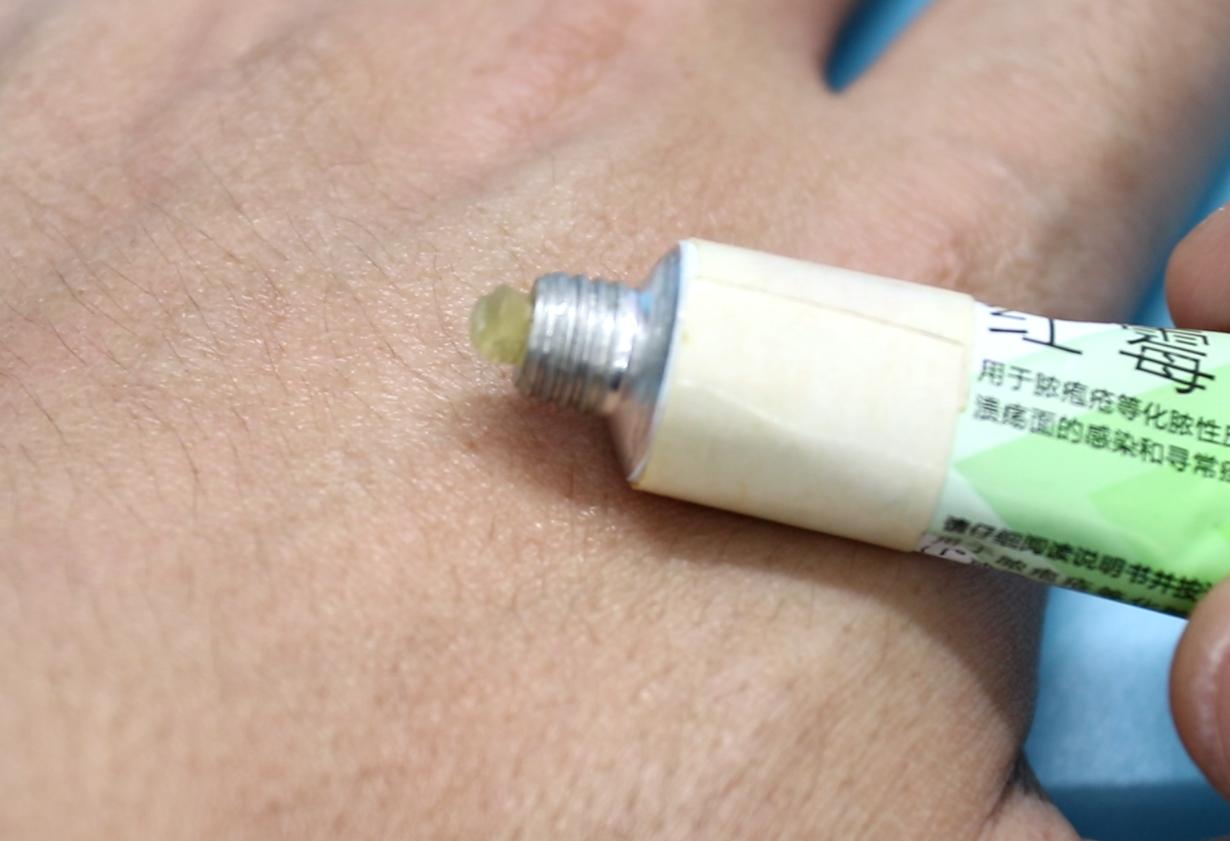 红霉素软膏如何合理运用,红霉素软膏的妙用你知道多少