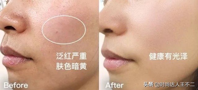 蔡少芬三胎顺利产子产后状态,蔡少芬三胎皮肤