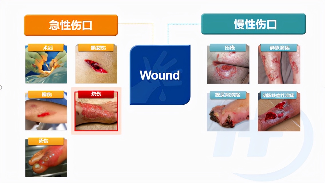 手术伤口愈合后怎么护理好得快,怎么护理伤口的视频