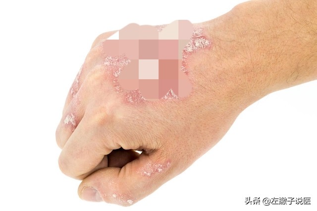 这六种病不用治不要再被忽悠了,6种病无法根治别再花冤枉钱了