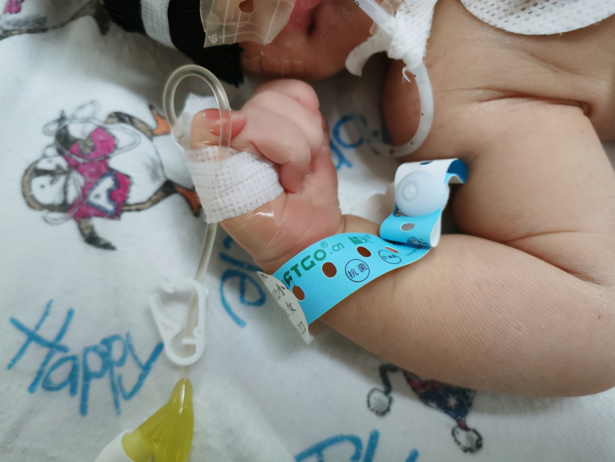 母婴血型不合新生儿溶血病,母婴血型相克