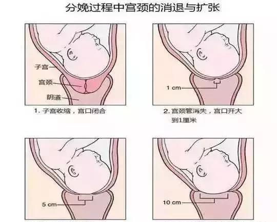 开十指一般多少厘米,开十指和不开十指区别