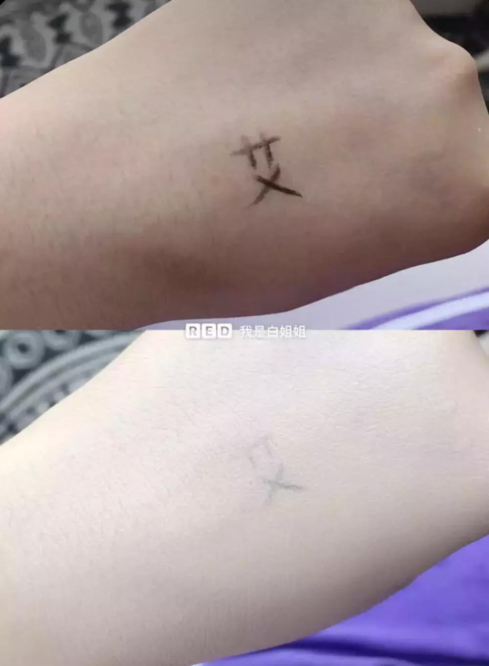 欧阳娜娜擦什么药膏好,欧阳娜娜安利祛疤膏