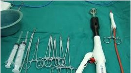 痔疮pph微创手术后很痛吗,pph微创手术的优缺点