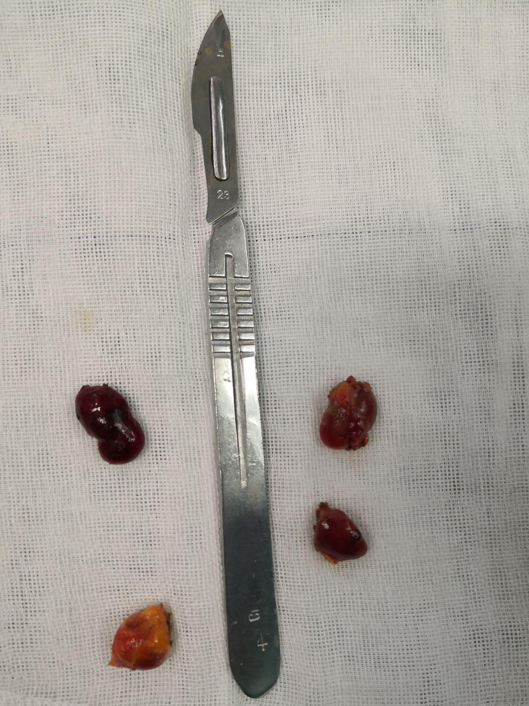 医院多学科协作抢救患者,太原中心医院甲状腺科