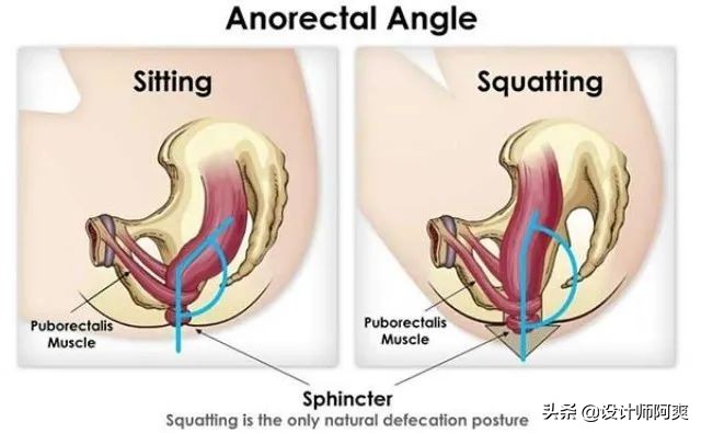 马桶和蹲厕哪个好,蹲厕好还是马桶好