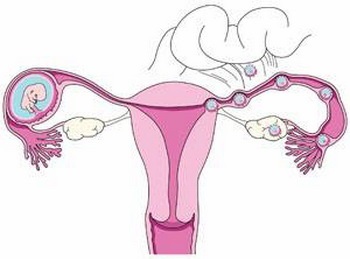 输卵管姐妹：主人，你为什么不要人家了？