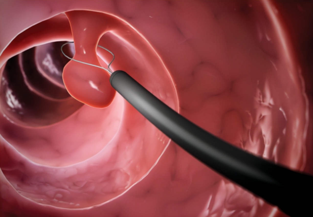 大便就是拉不干净是怎么回事,大便一直觉得拉不干净是什么问题