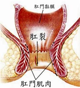 一岁宝宝肛裂后怎么排便,孩子便秘肛裂看什么科大便特别粗