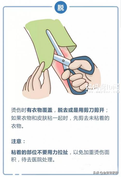 又有婴儿被烫伤，急救方法你会吗？