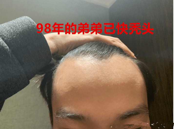 uu鏈夊紵寮熶箞,UU鏈夊紵寮熷悧