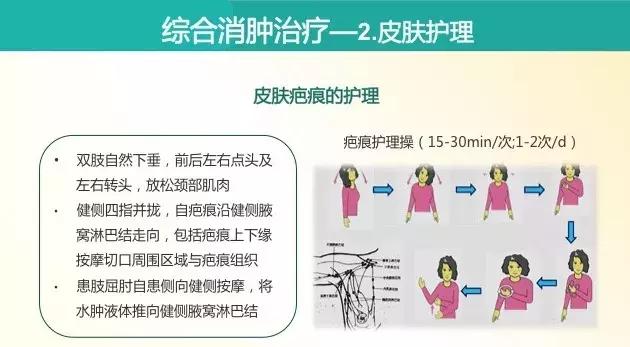 乳腺癌放疗水肿怎样解决,乳腺癌放疗后出现水肿怎么办