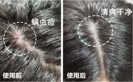 澳洲茶树精油洗发水去头屑,头发一摸全是油