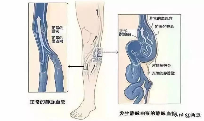 娜扎长筒袜,娜扎瘦腿袜