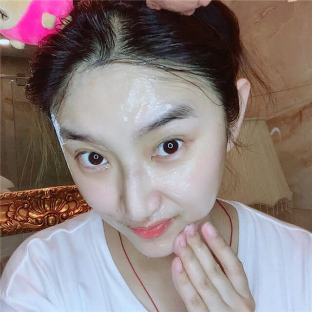 面部毛孔粗大如何改善,面部毛孔粗大怎么办如何改善