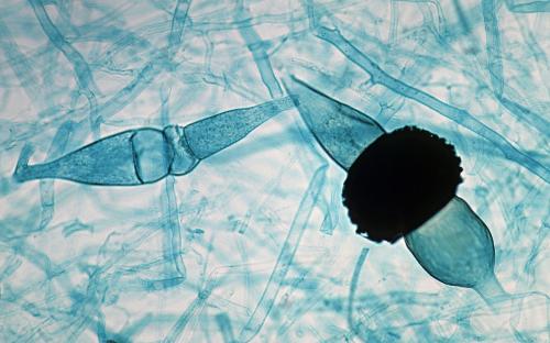 一文解答：甲沟炎的诊断方法和检查项目都有哪些？