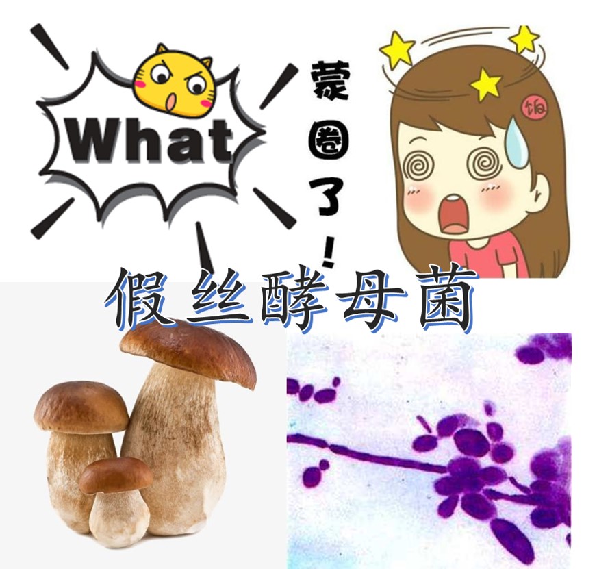 难言的瘙痒——“霉菌”