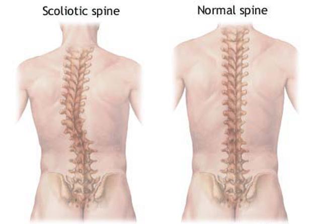 儿童左右腿骨骼发育不一致,2岁男童走路好像腿软总是摔倒