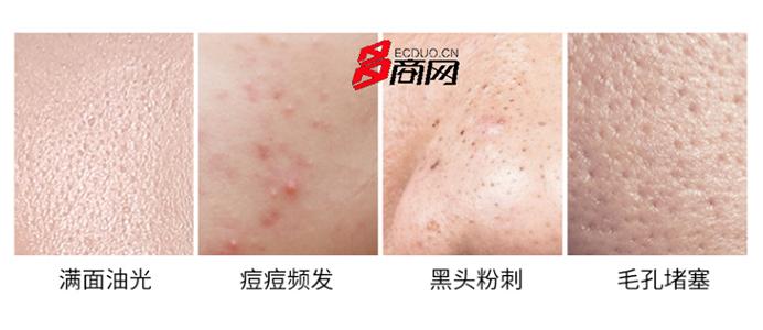 抗痘干货总结亲身经历教大家祛痘,多年痘疤修复药膏