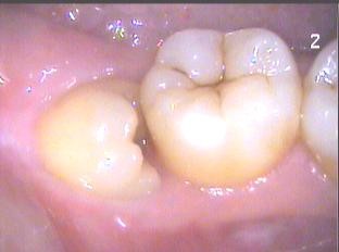 美国警察跪杀案宣判,美国警察跪杀案例