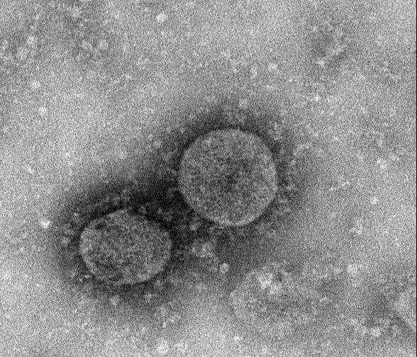 冠状病毒长什么样,新冠状病毒结构示意图高清