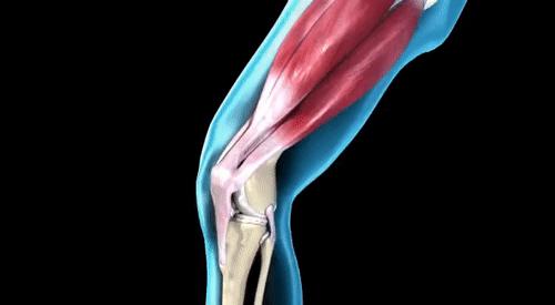 半月板受损怎么办,半月板受损是不是膝盖伸不直