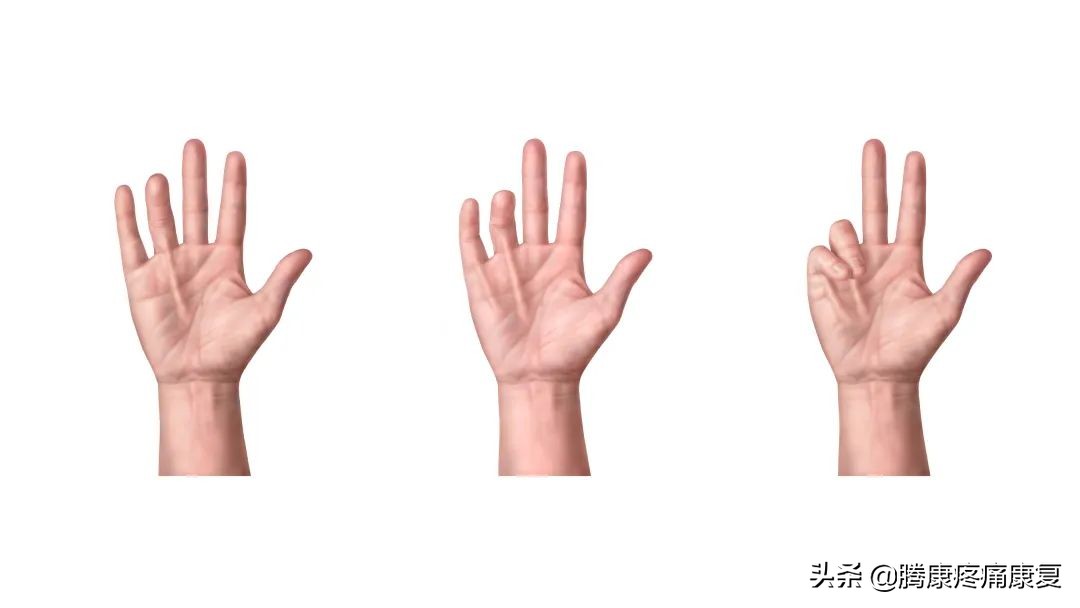 手掌腱膜挛缩不手术会怎样发展,头帽状腱膜挛缩症最新治疗方法