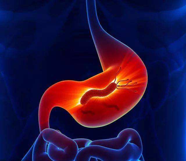 感染幽门螺旋杆菌怎样才算根治,感染了幽门螺旋杆菌怎么治