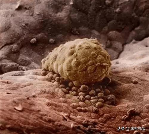 将光导管与内窥镜相机连接，向全世界展示了人类生命诞生的奥妙