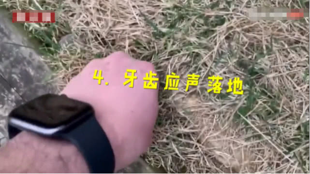 最硬核的拔牙方式！老爸把女儿乳牙绑特斯拉上，刚启动牙就掉了