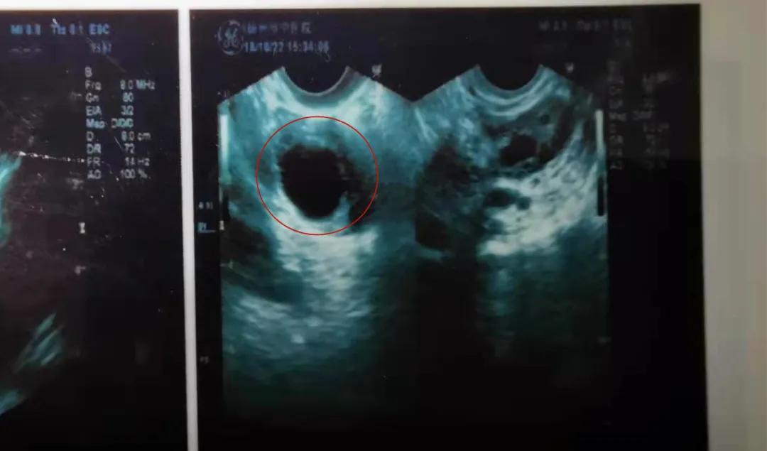 在美国娶妻生子是种什么体验,男人结婚生子是什么体验