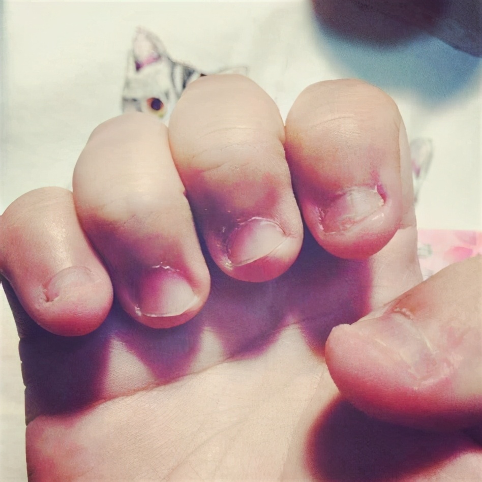 四岁宝宝啃手指甲脚趾甲怎么回事,四岁宝宝啃脚指甲怎么回事