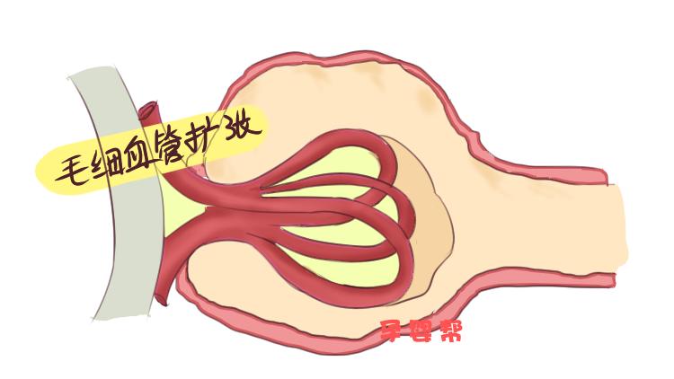 宝宝胎记越长越大，婆婆却夸赞是福气，医生的话让全家紧张