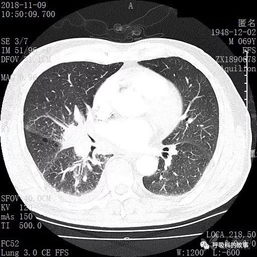 怎么应用统计学做调查,统计学方法可以解决的主要问题
