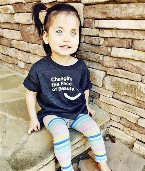 中国“蓝眼睛”女孩一出生就被抛弃,美国夫妇跨国领养,如今怎样