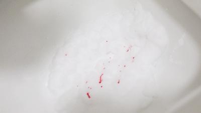 拉屎的时候怎么防止溅水,教你怎么拉粑粑不粘马桶上