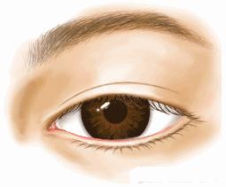 各种双眼皮类型,四种公认最丑双眼皮