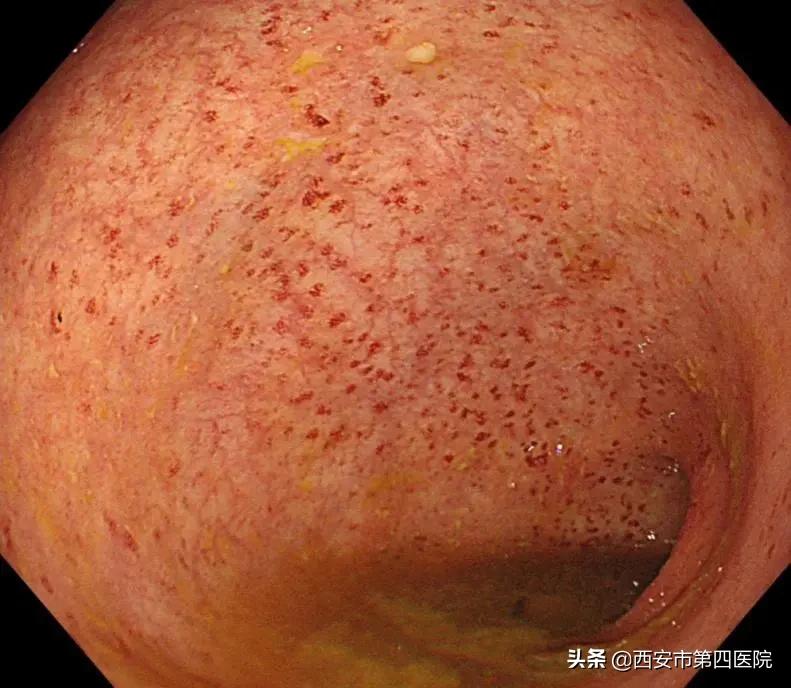 健康中国2023重大行动,健康中国行动是真是假