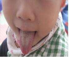 小孩体内有寒又有热怎么调理,小孩体内热怎么调理最快