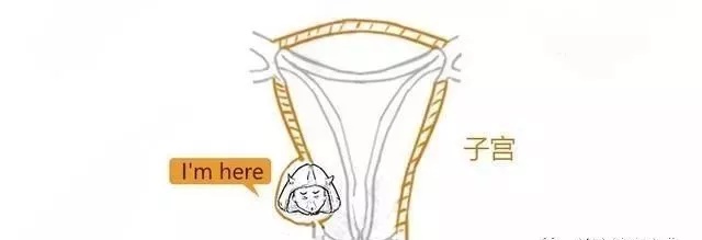 子宫肌瘤动漫演示,子宫肌瘤是什么原因导致的漫画